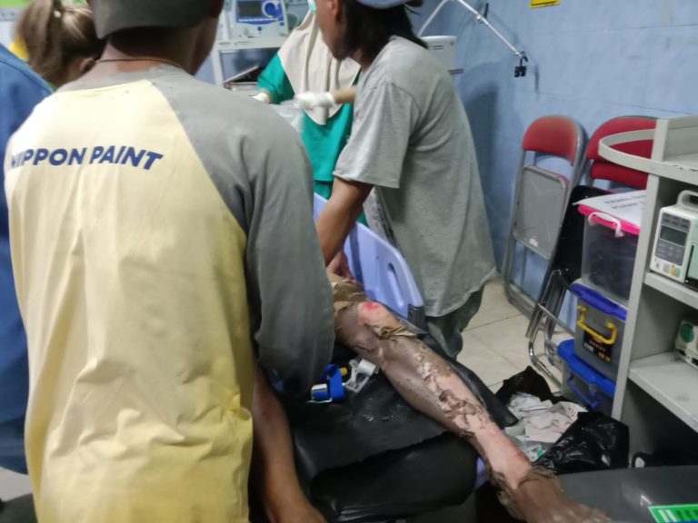 Pasang Baja Ringan Kuli Bangunan Kesetrum Listrik Tegangan Tinggi